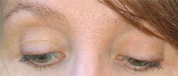 Deborah Crowley's Eyes  Age 65 Founder of FlexEffect Facialbuilding